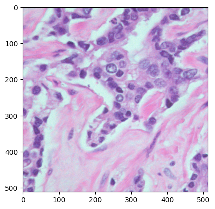 Nuclei Segmentation 1
